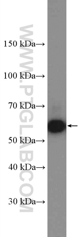 Western Blot (WB) analysis of NIH/3T3 cells using AKT2 Polyclonal antibody (17609-1-AP)