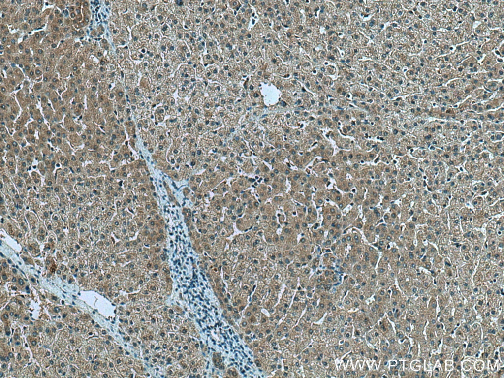 Immunohistochemistry (IHC) staining of human liver tissue using AKT2 Polyclonal antibody (28113-1-AP)