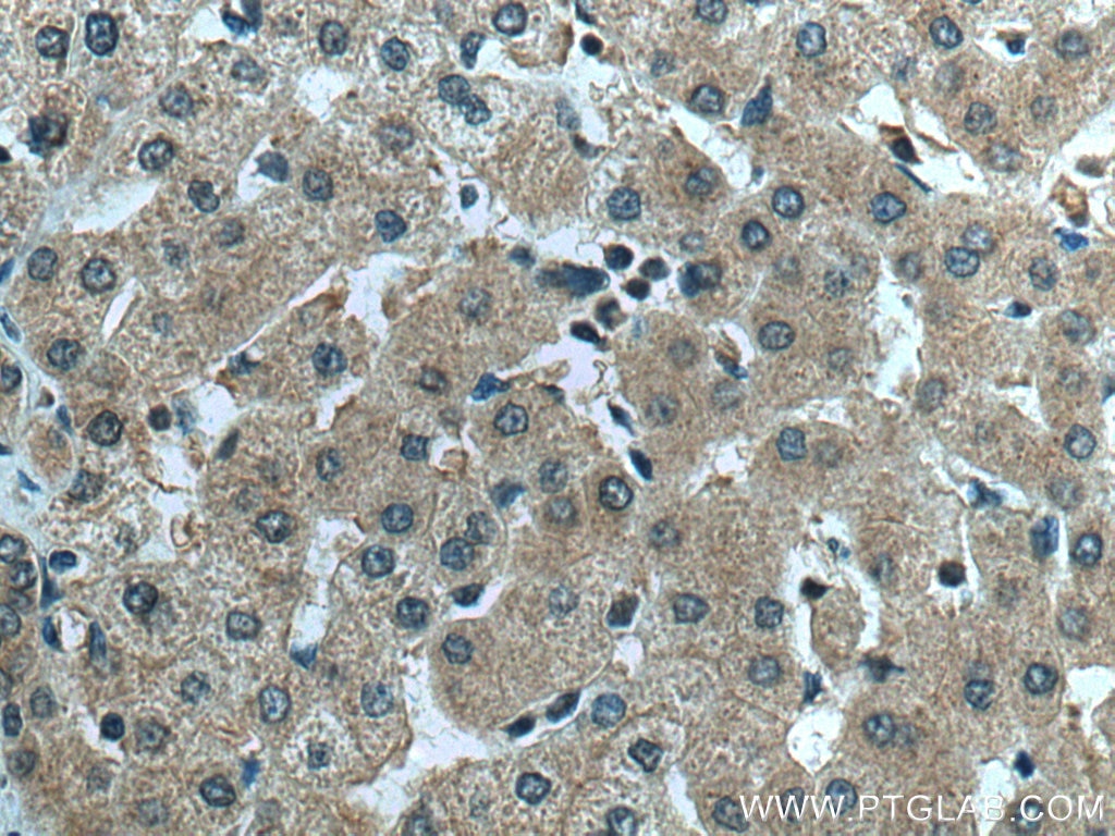 Immunohistochemistry (IHC) staining of human liver tissue using AKT2 Polyclonal antibody (28113-1-AP)