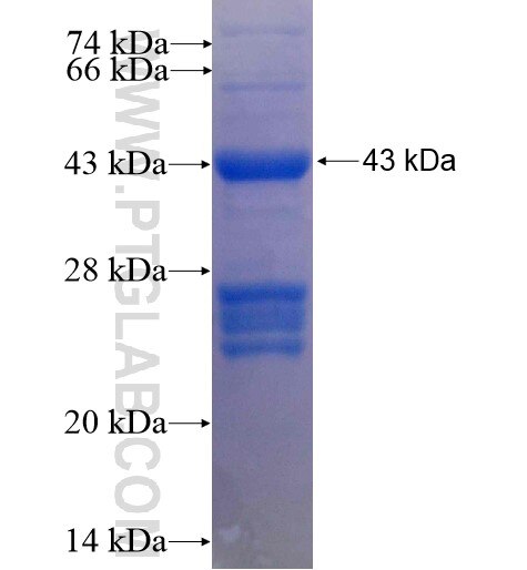 AKT2 fusion protein Ag11770 SDS-PAGE