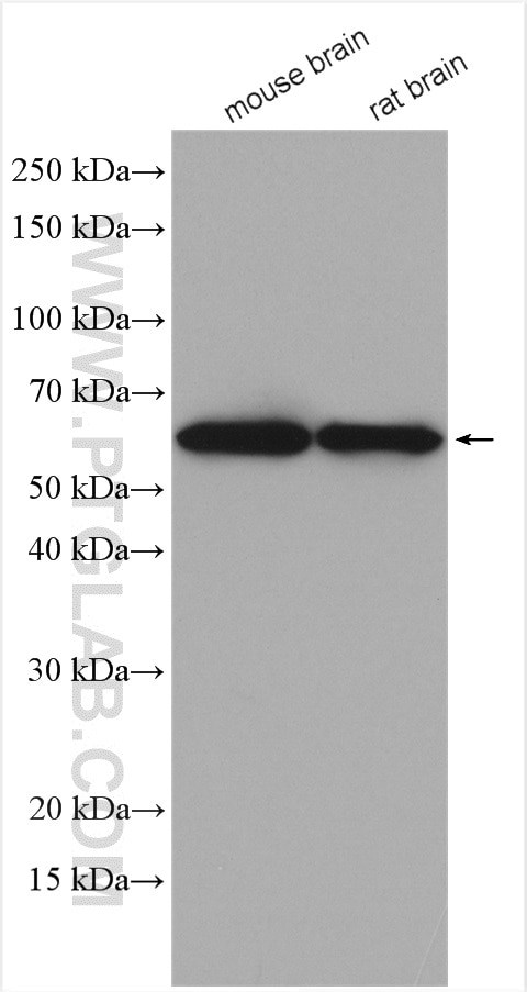 Western Blot (WB) analysis of various lysates using AKT3 Polyclonal antibody (21641-1-AP)