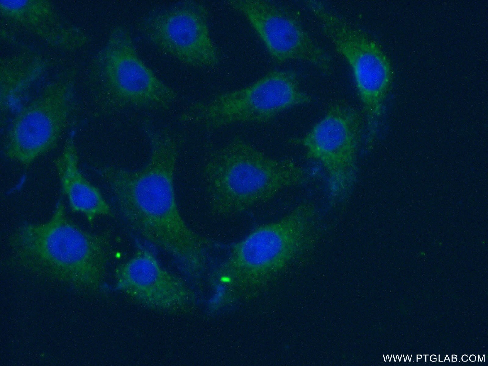 Immunofluorescence (IF) / fluorescent staining of SH-SY5Y cells using AKTIP Polyclonal antibody (14860-1-AP)