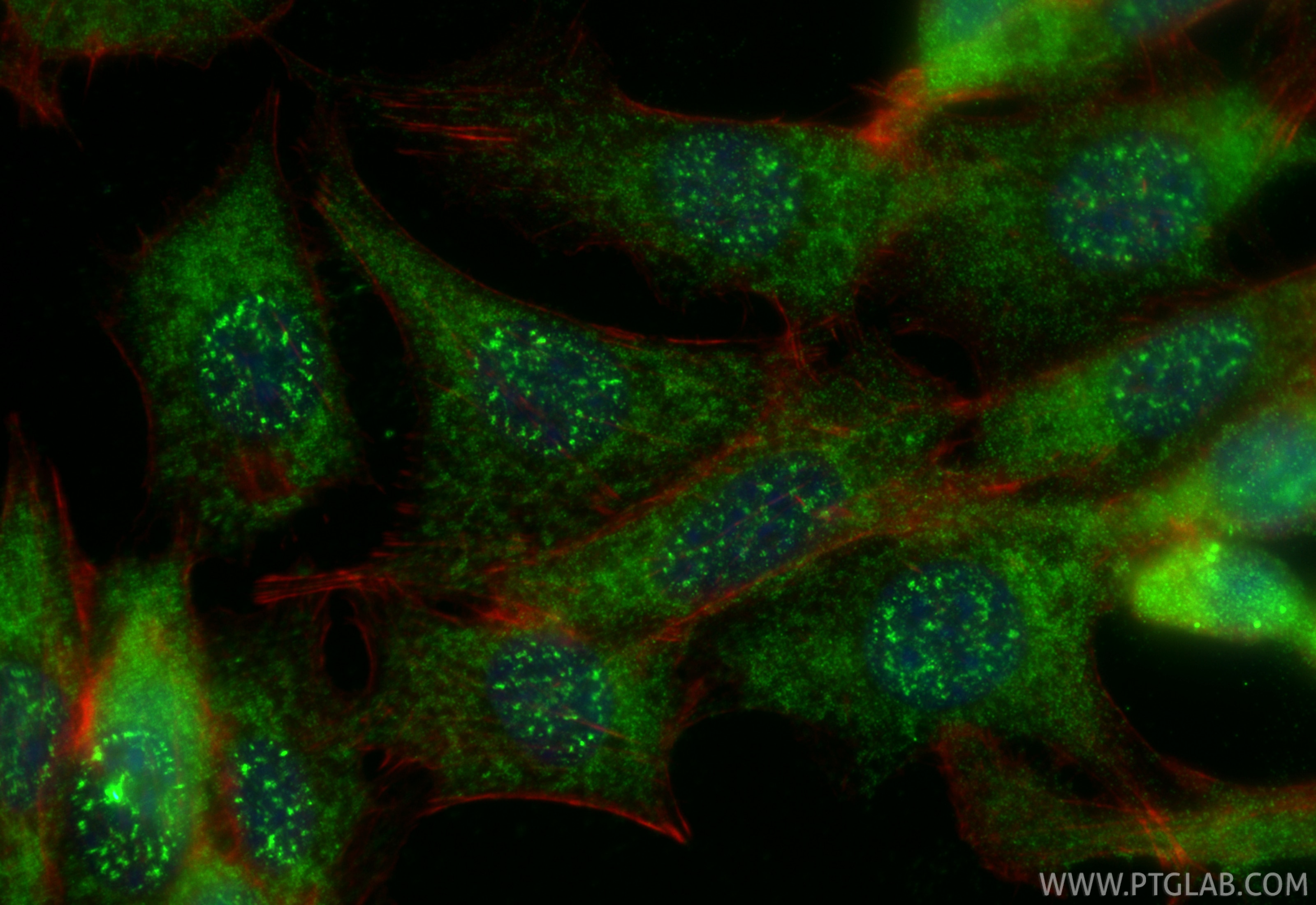 Immunofluorescence (IF) / fluorescent staining of NIH/3T3 cells using AKTIP Polyclonal antibody (14860-1-AP)