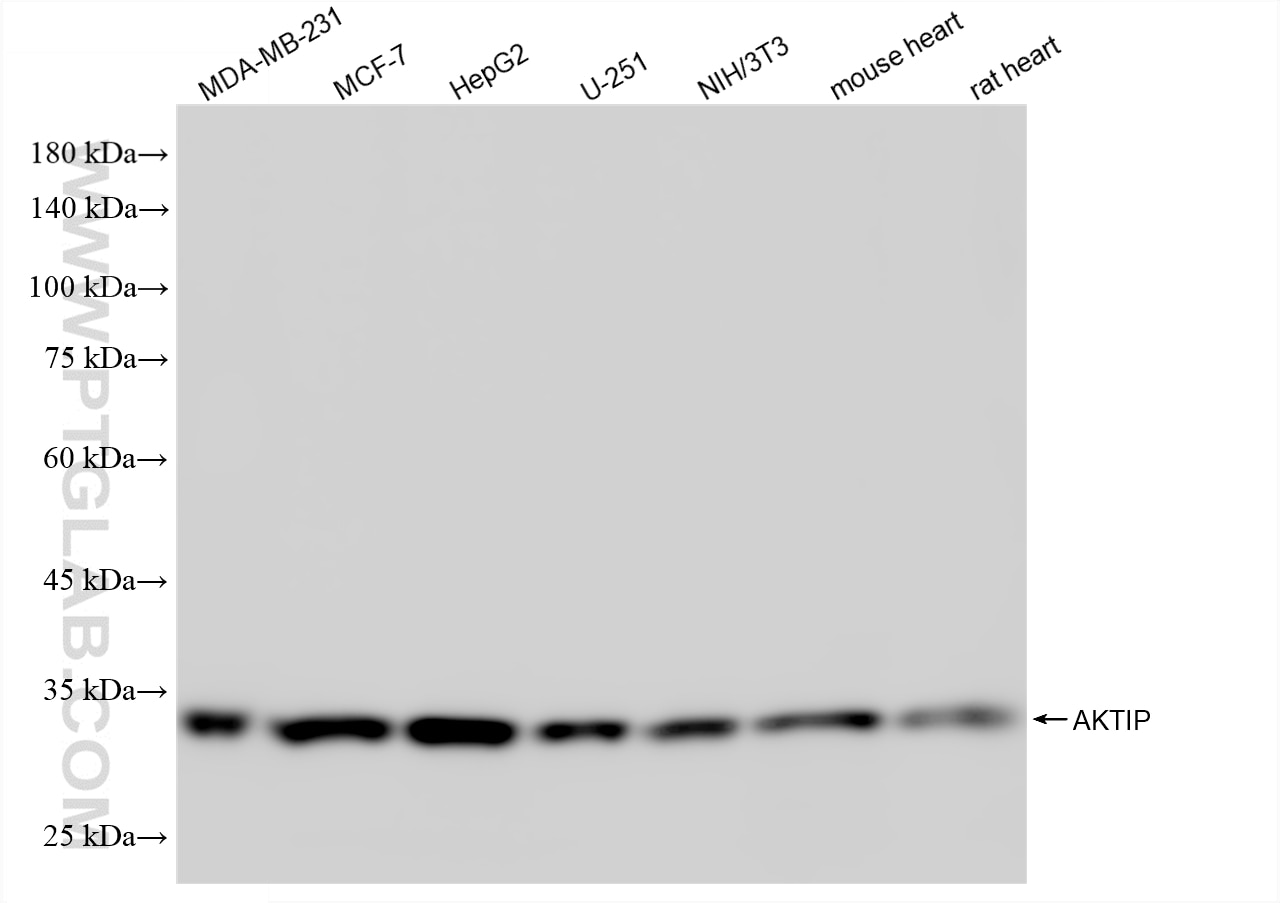 Various lysates were subjected to SDS PAGE followed by western blot with 86988-1-RR (AKTIP antibody) at dilution of 1:10000 incubated at room temperature for 1.5 hours. This data was developed using the same antibody clone with 86988-1-PBS in a different storage buffer formulation. Western Blot (WB) analysis of various lysates using AKTIP Recombinant monoclonal antibody (86988-1-RR)