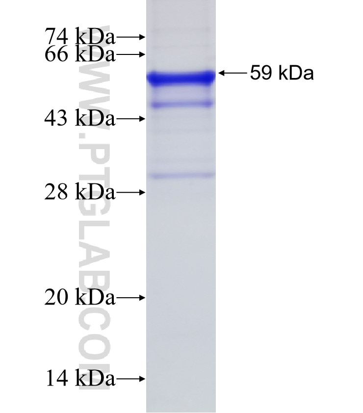 AKTIP fusion protein Ag6662 SDS-PAGE