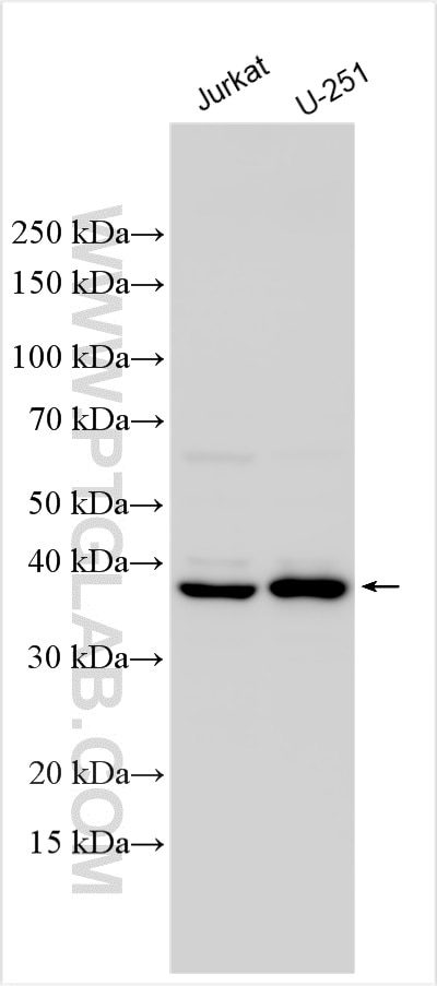 Western Blot (WB) analysis of various lysates using ALAD Polyclonal antibody (31686-1-AP)