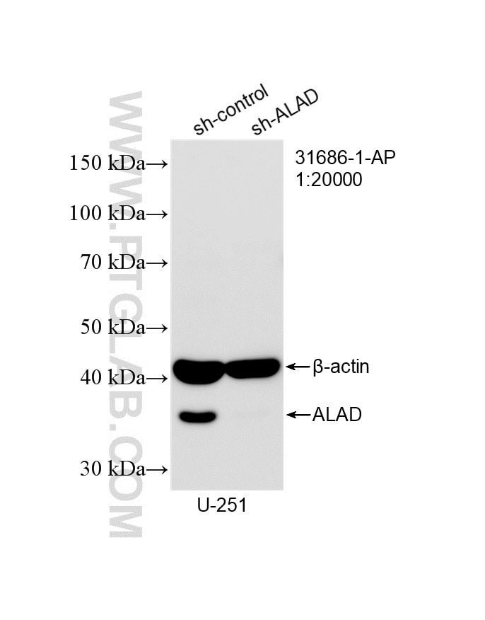 Western Blot (WB) analysis of U-251 cells using ALAD Polyclonal antibody (31686-1-AP)