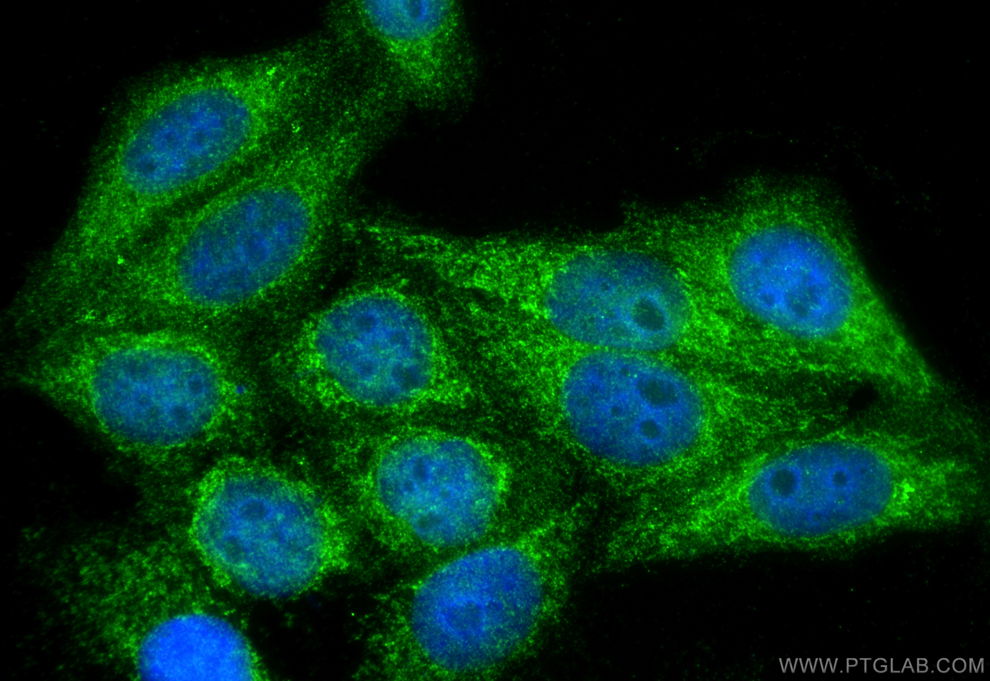 Immunofluorescence (IF) / fluorescent staining of HepG2 cells using ALAS1 Polyclonal antibody (16200-1-AP)
