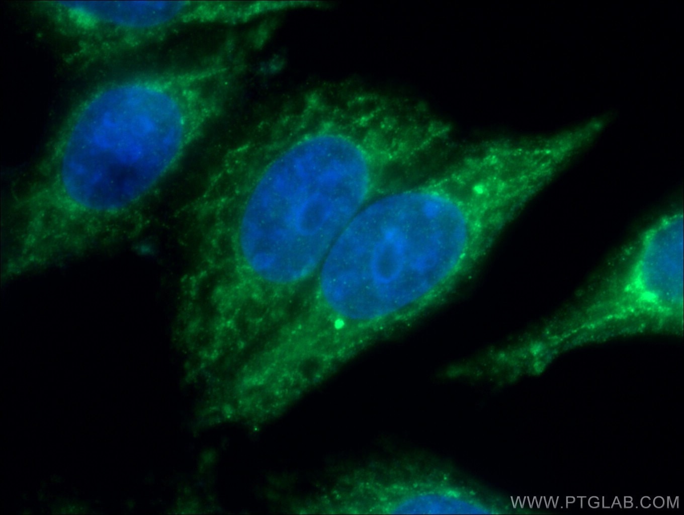 Immunofluorescence (IF) / fluorescent staining of HepG2 cells using ALAS1 Polyclonal antibody (16200-1-AP)