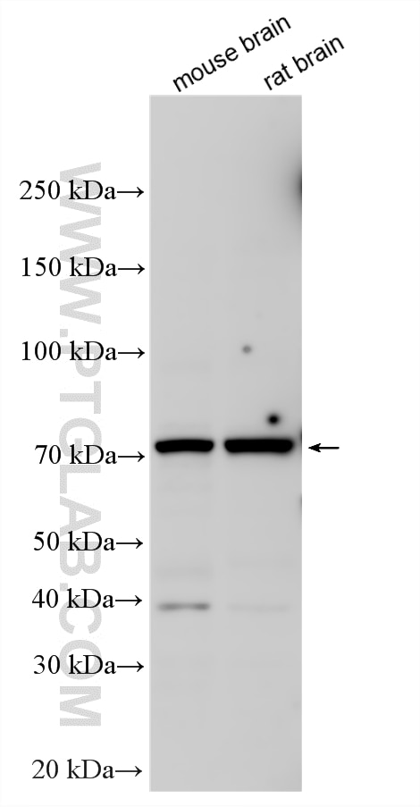 Various lysates were subjected to SDS PAGE followed by western blot with 16200-1-AP (ALAS1 antibody) at dilution of 1:1000 incubated at room temperature for 1.5 hours. Western Blot (WB) analysis of various lysates using ALAS1 Polyclonal antibody (16200-1-AP)