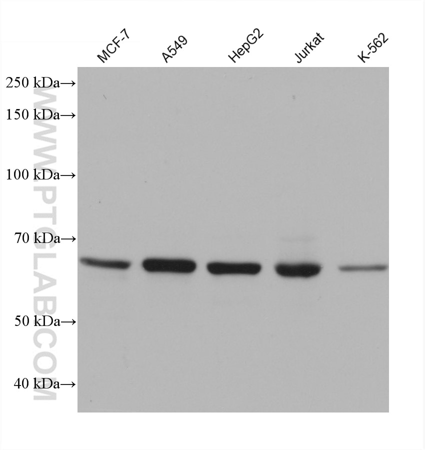 Western Blot (WB) analysis of various lysates using ALAS1 Monoclonal antibody (68567-1-Ig)