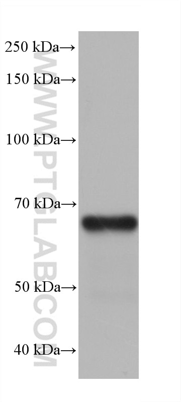 Western Blot (WB) analysis of pig adrenal gland tissue using ALAS1 Monoclonal antibody (68567-1-Ig)