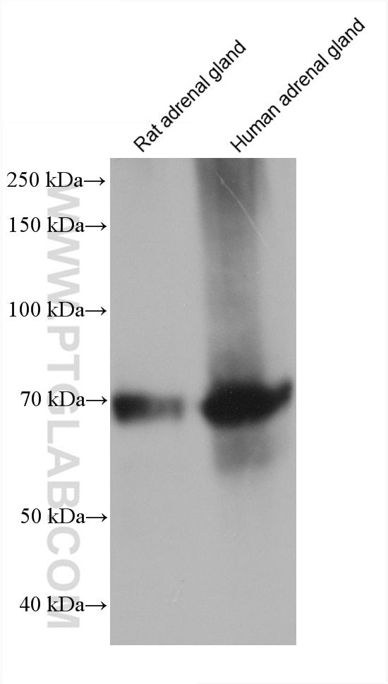 Western Blot (WB) analysis of various lysates using ALAS1 Monoclonal antibody (68567-1-Ig)