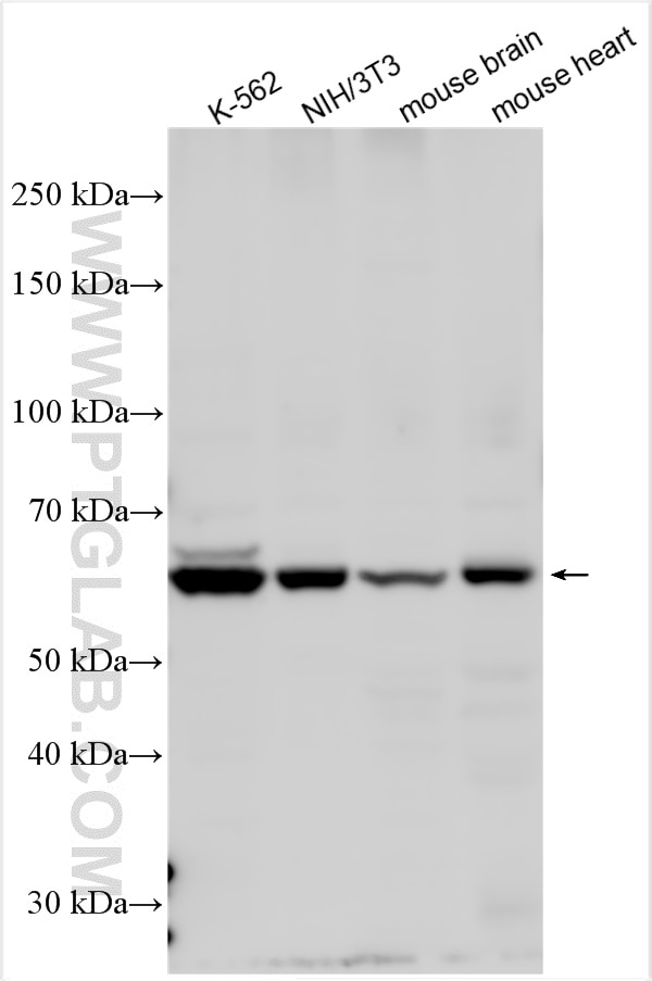 Western Blot (WB) analysis of various lysates using ALAS2 Polyclonal antibody (30539-1-AP)