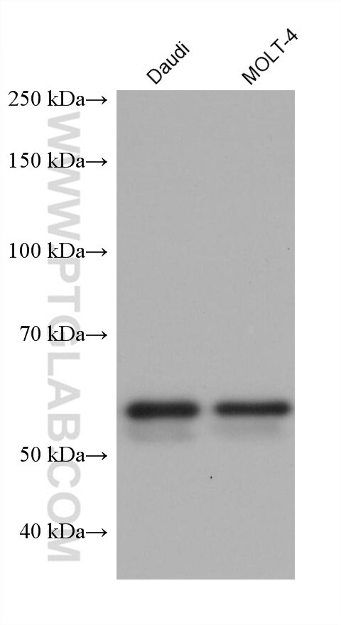 Western Blot (WB) analysis of various lysates using ALAS2 Monoclonal antibody (68332-1-Ig)