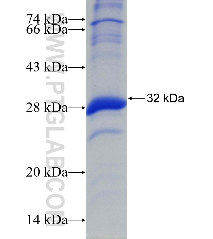 ALAS2 fusion protein Ag30308 SDS-PAGE