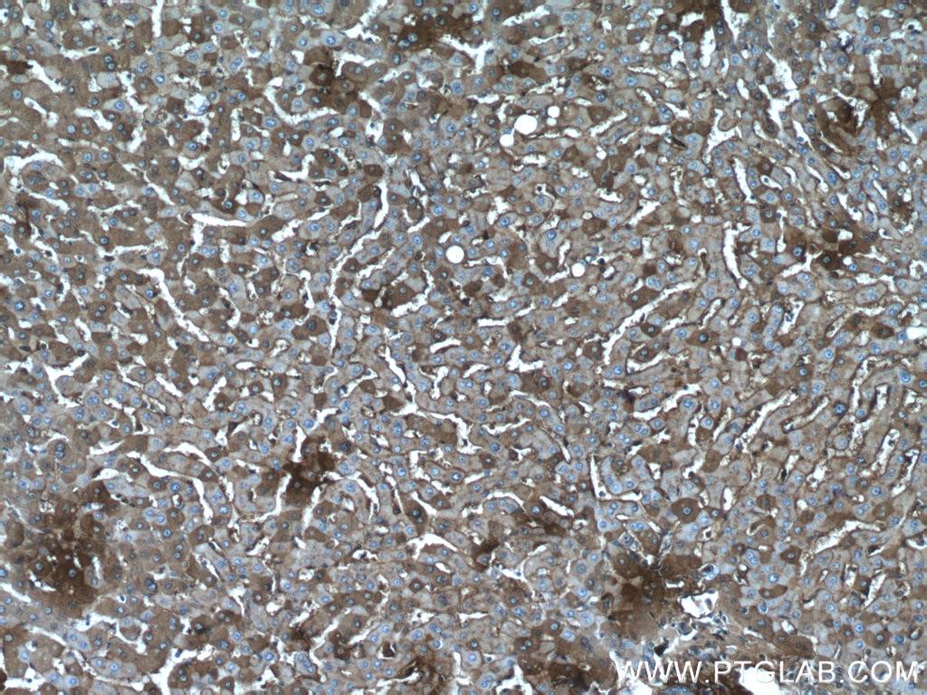 Immunohistochemistry (IHC) staining of human liver tissue using Albumin Polyclonal antibody (16475-1-AP)