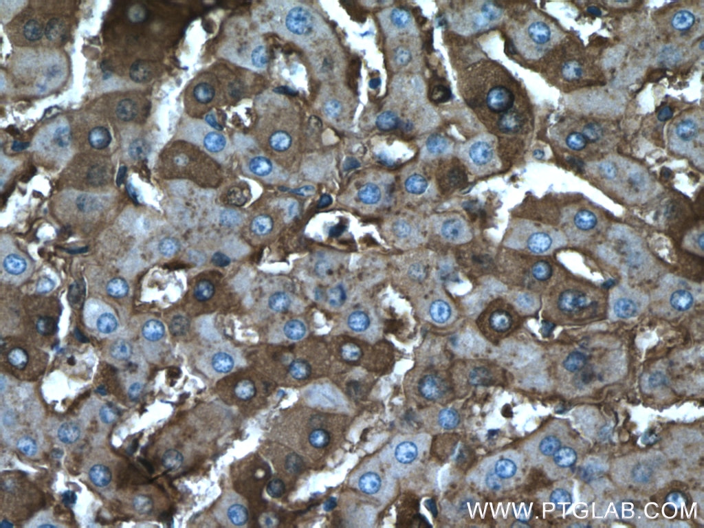 Immunohistochemistry (IHC) staining of human liver tissue using Albumin Polyclonal antibody (16475-1-AP)
