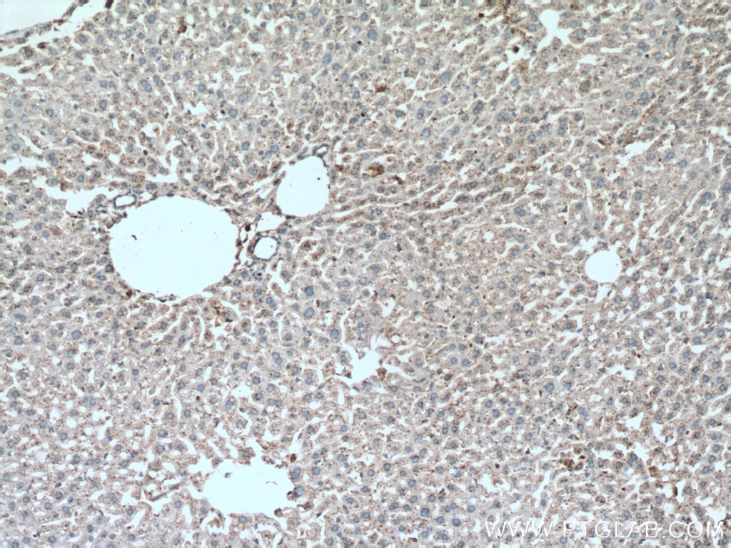 Immunohistochemistry (IHC) staining of mouse liver tissue using Albumin Polyclonal antibody (16475-1-AP)