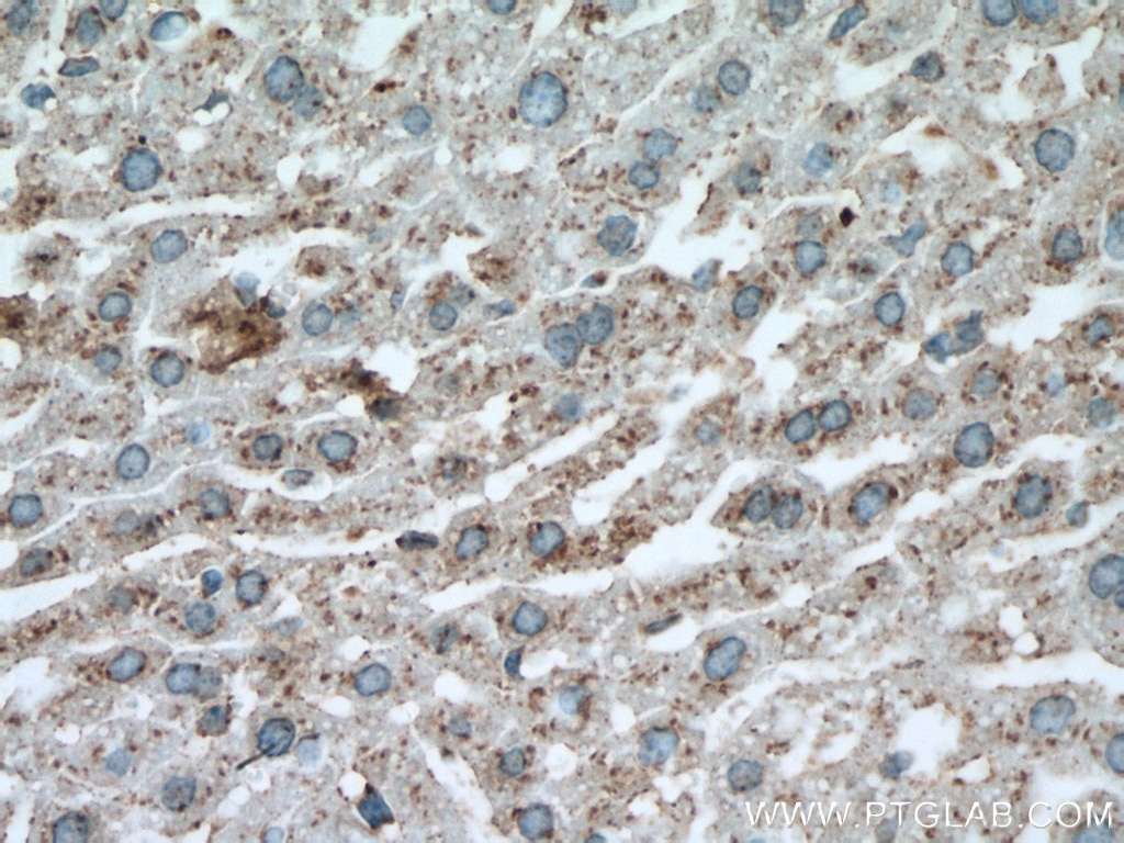 Immunohistochemistry (IHC) staining of mouse liver tissue using Albumin Polyclonal antibody (16475-1-AP)