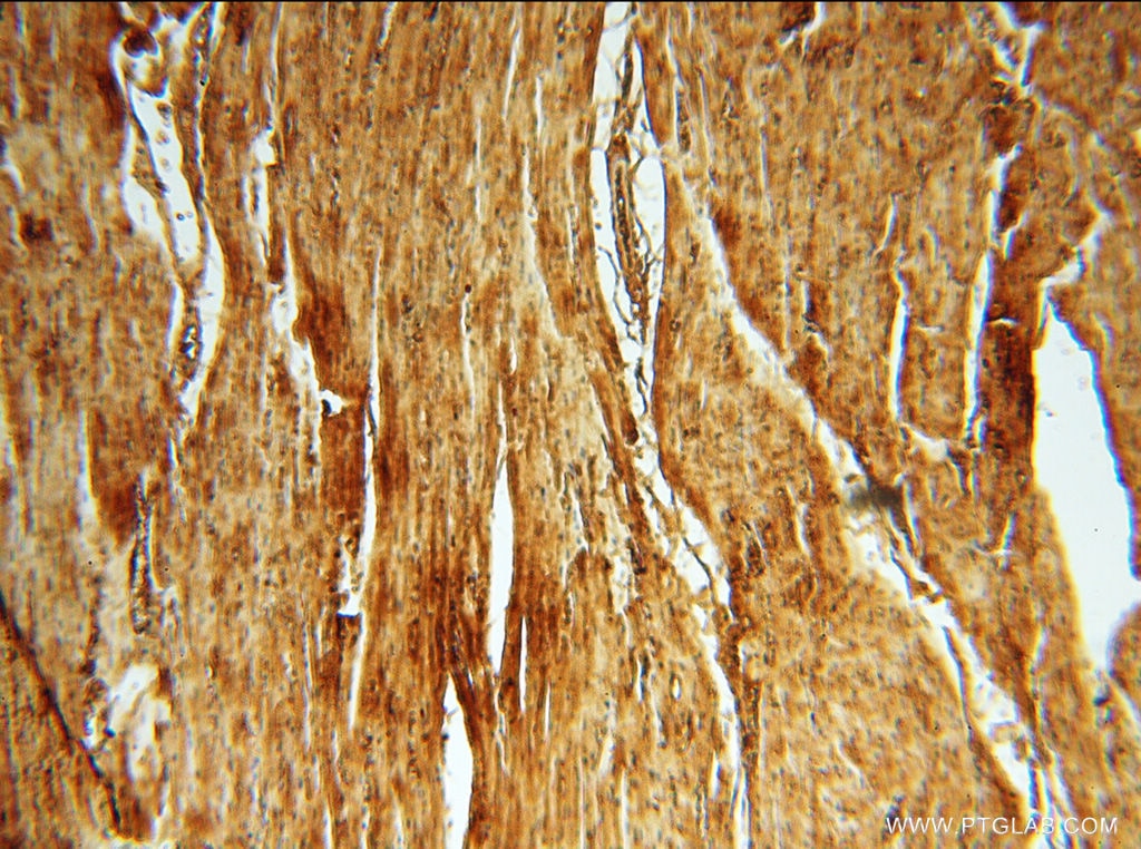 Immunohistochemistry (IHC) staining of human heart tissue using Albumin Polyclonal antibody (16475-1-AP)