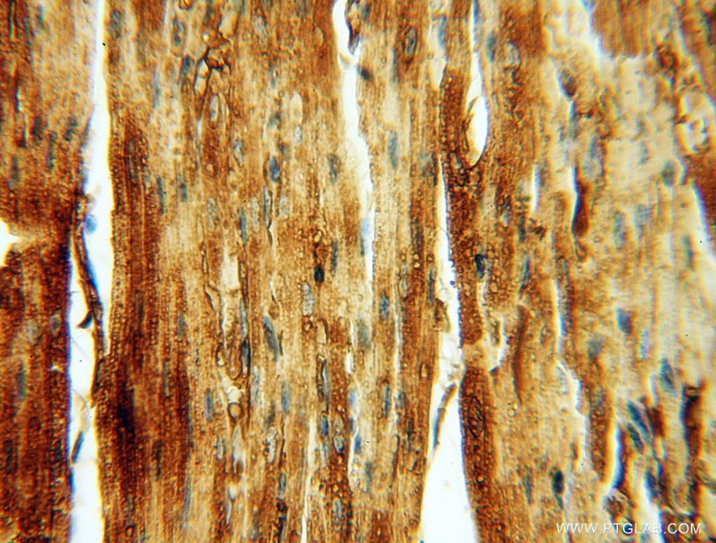 Immunohistochemistry (IHC) staining of human heart tissue using Albumin Polyclonal antibody (16475-1-AP)