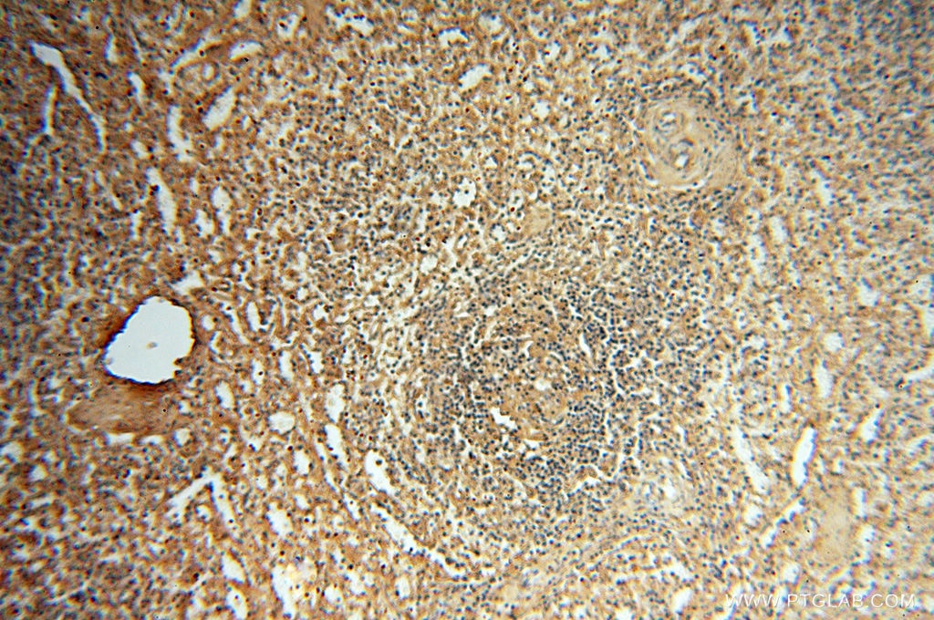 Immunohistochemistry (IHC) staining of human spleen tissue using Albumin Polyclonal antibody (16475-1-AP)