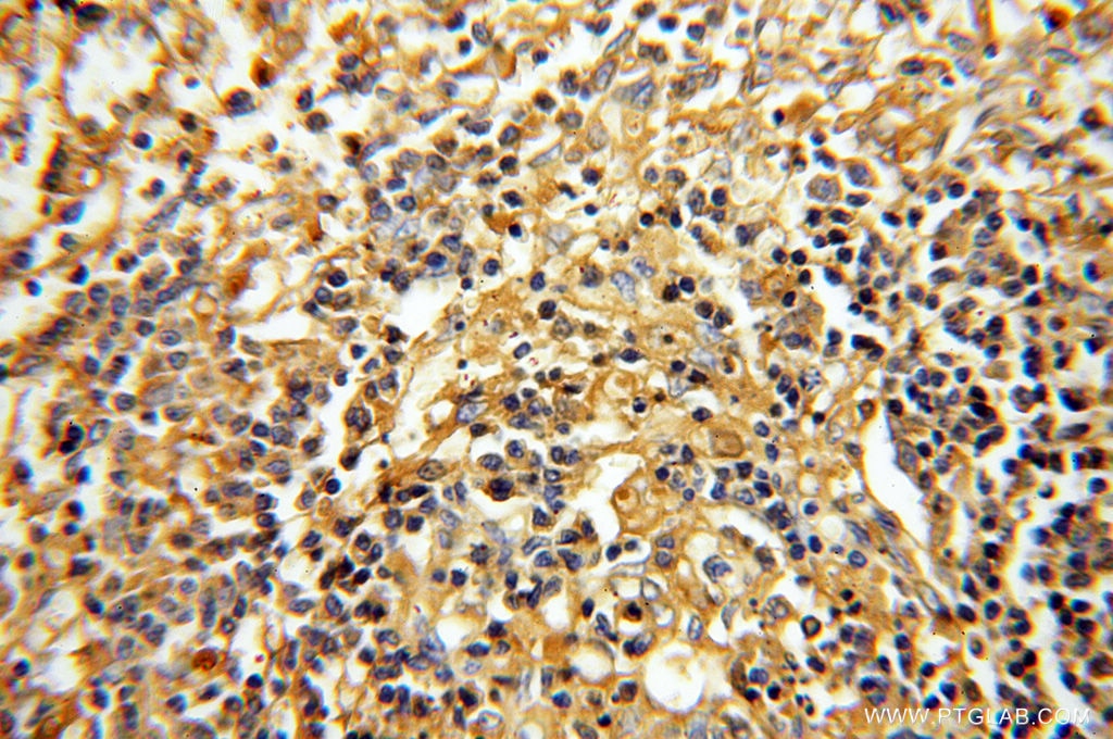 Immunohistochemistry (IHC) staining of human spleen tissue using Albumin Polyclonal antibody (16475-1-AP)