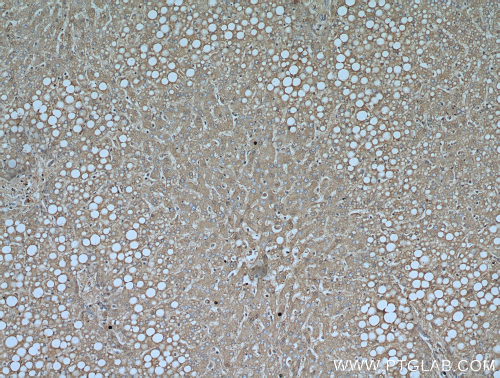 IHC staining of human liver using 16475-1-AP