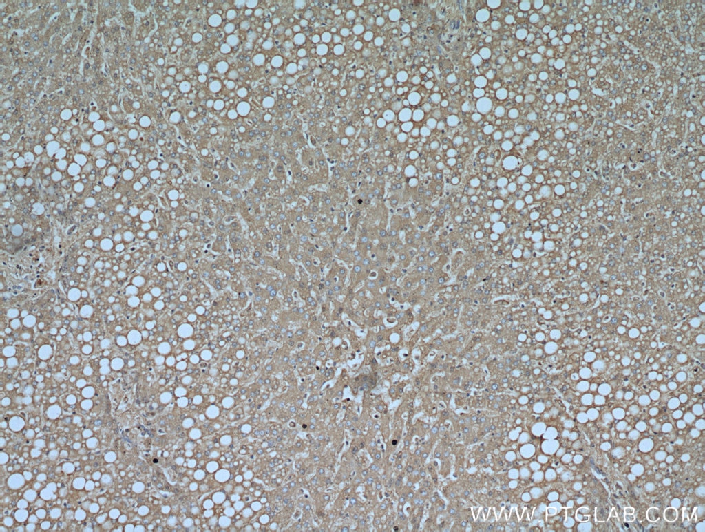 Immunohistochemistry (IHC) staining of human liver tissue using Albumin Polyclonal antibody (16475-1-AP)