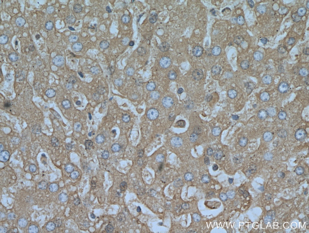 IHC staining of human liver using 16475-1-AP