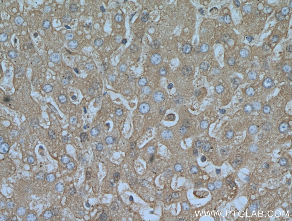 Immunohistochemistry (IHC) staining of human liver tissue using Albumin Polyclonal antibody (16475-1-AP)