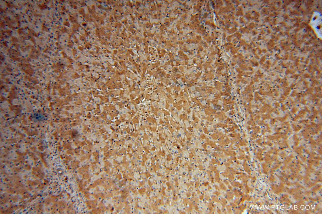 Albumin Polyclonal antibody