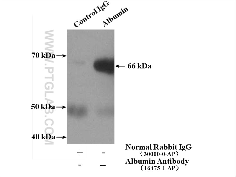Immunoprecipitation (IP) experiment of human plasma using Albumin Polyclonal antibody (16475-1-AP)