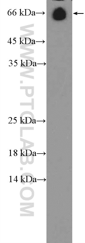WB analysis of mouse serum using 16475-1-AP