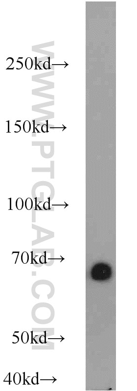Western Blot (WB) analysis of human plasma using Albumin Polyclonal antibody (16475-1-AP)
