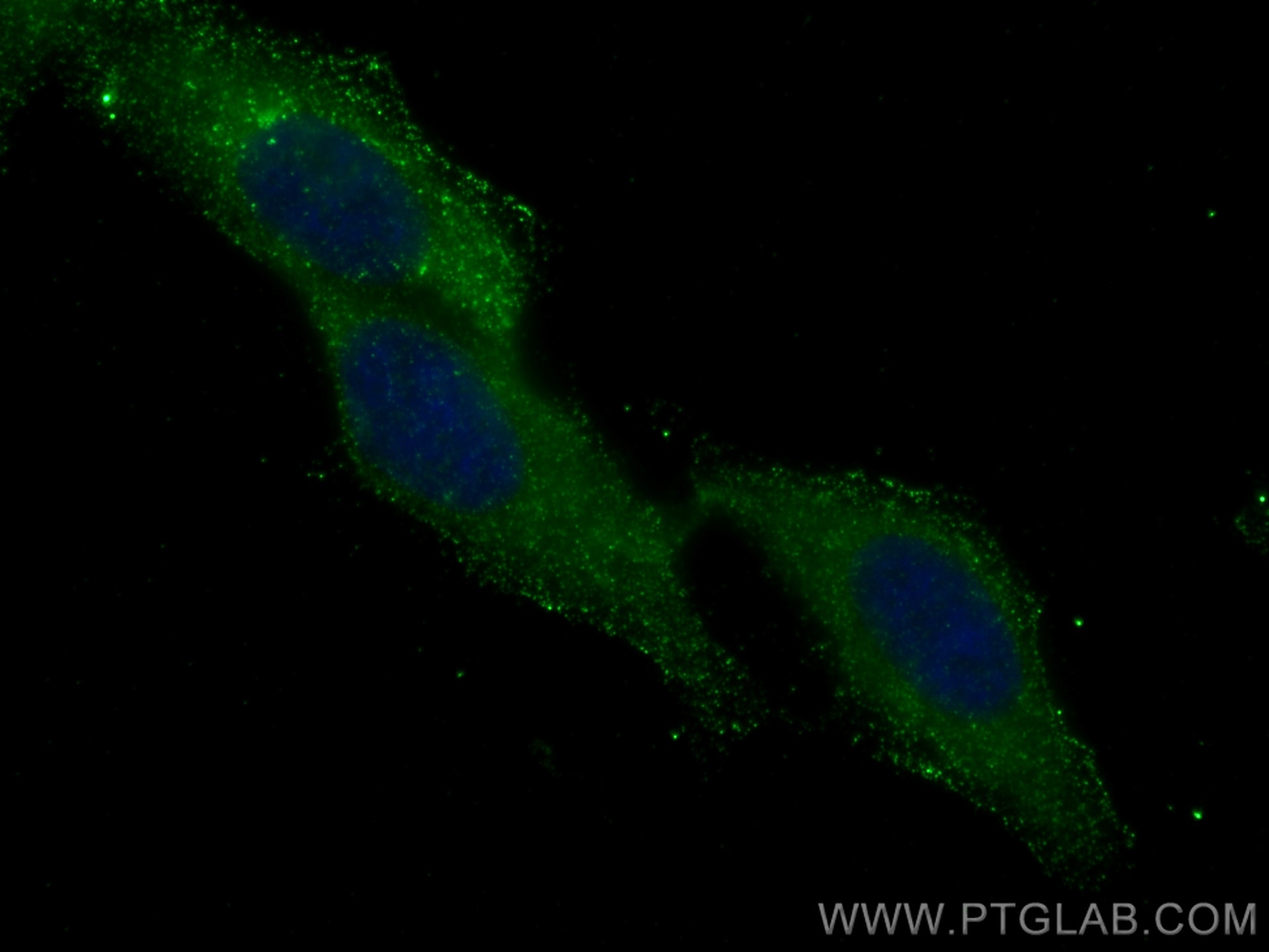 Immunofluorescence (IF) / fluorescent staining of HepG2 cells using Albumin Monoclonal antibody (66051-1-Ig)