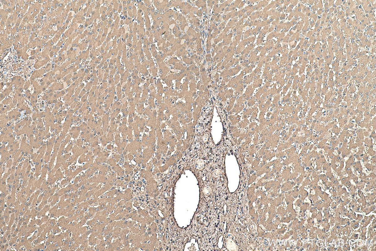Immunohistochemistry (IHC) staining of human liver tissue using Albumin Monoclonal antibody (66051-1-Ig)