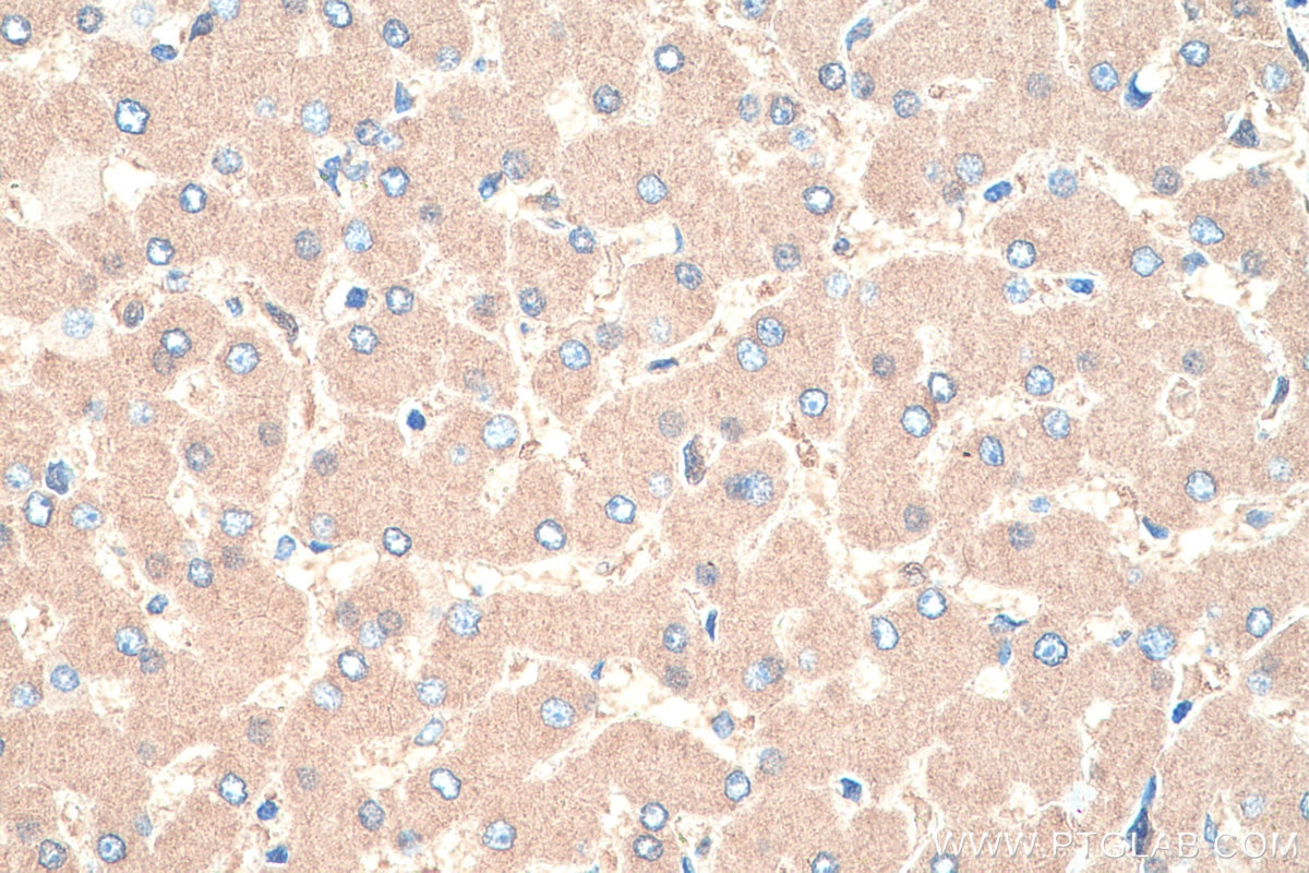 Immunohistochemistry (IHC) staining of human liver tissue using Albumin Monoclonal antibody (66051-1-Ig)