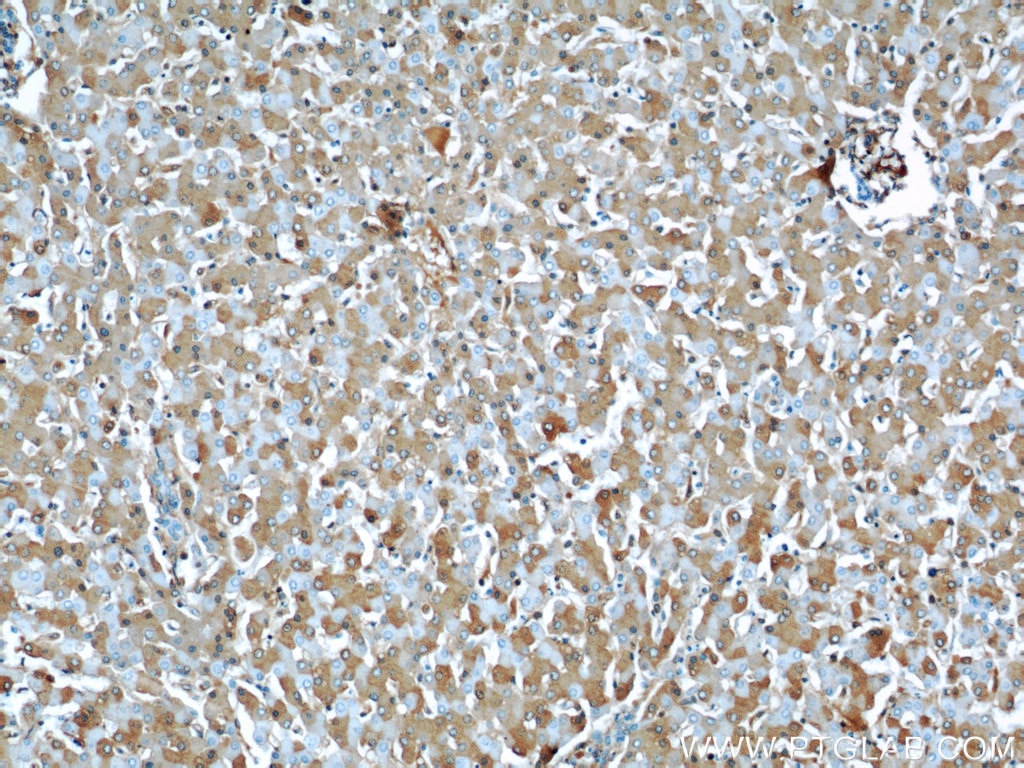 Immunohistochemistry (IHC) staining of human liver tissue using Albumin Monoclonal antibody (66051-1-Ig)