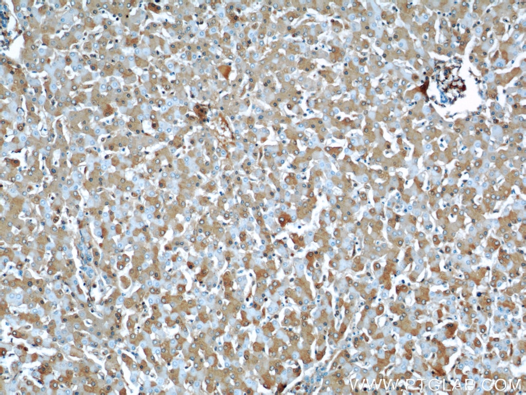 IHC staining of human liver using 66051-1-Ig