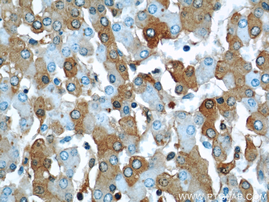 Immunohistochemistry (IHC) staining of human liver tissue using Albumin Monoclonal antibody (66051-1-Ig)