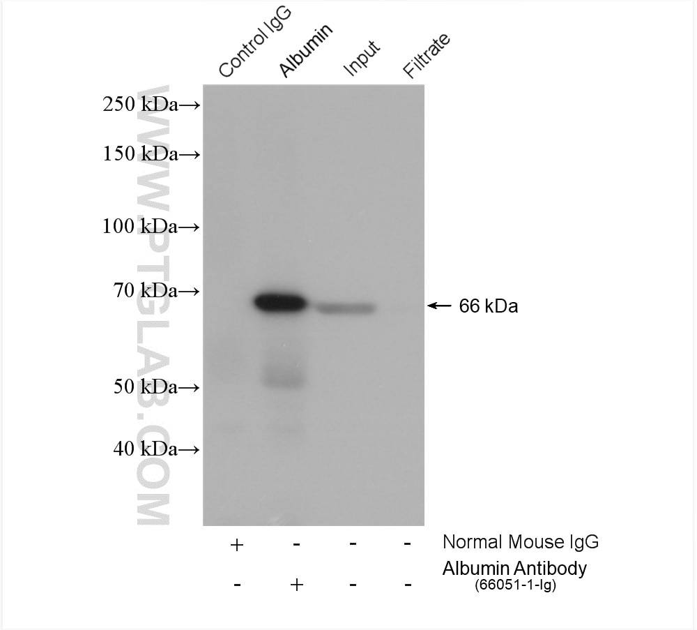 Immunoprecipitation (IP) experiment of HepG2 cells using Albumin Monoclonal antibody (66051-1-Ig)