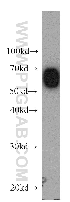 Western Blot (WB) analysis of human liver tissue using Albumin Monoclonal antibody (66051-1-Ig)