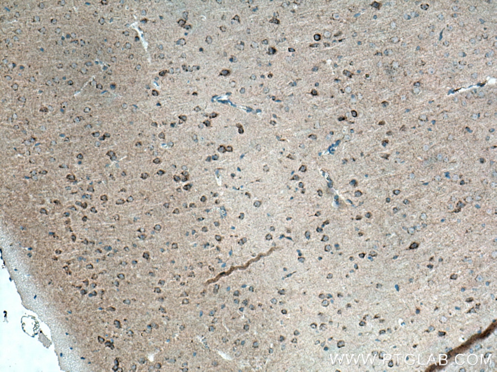 Immunohistochemistry (IHC) staining of mouse brain tissue using ALCAM Polyclonal antibody (21972-1-AP)