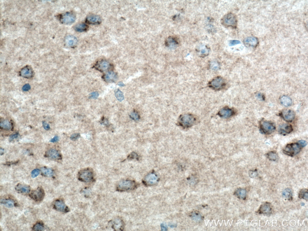 Immunohistochemistry (IHC) staining of mouse brain tissue using ALCAM Polyclonal antibody (21972-1-AP)