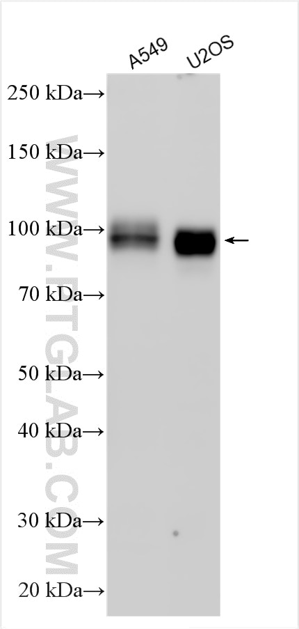 Western Blot (WB) analysis of various lysates using ALCAM Polyclonal antibody (21972-1-AP)