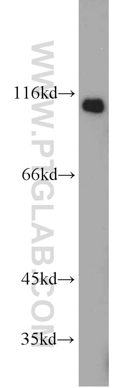 Western Blot (WB) analysis of human liver tissue using ALCAM Polyclonal antibody (21972-1-AP)