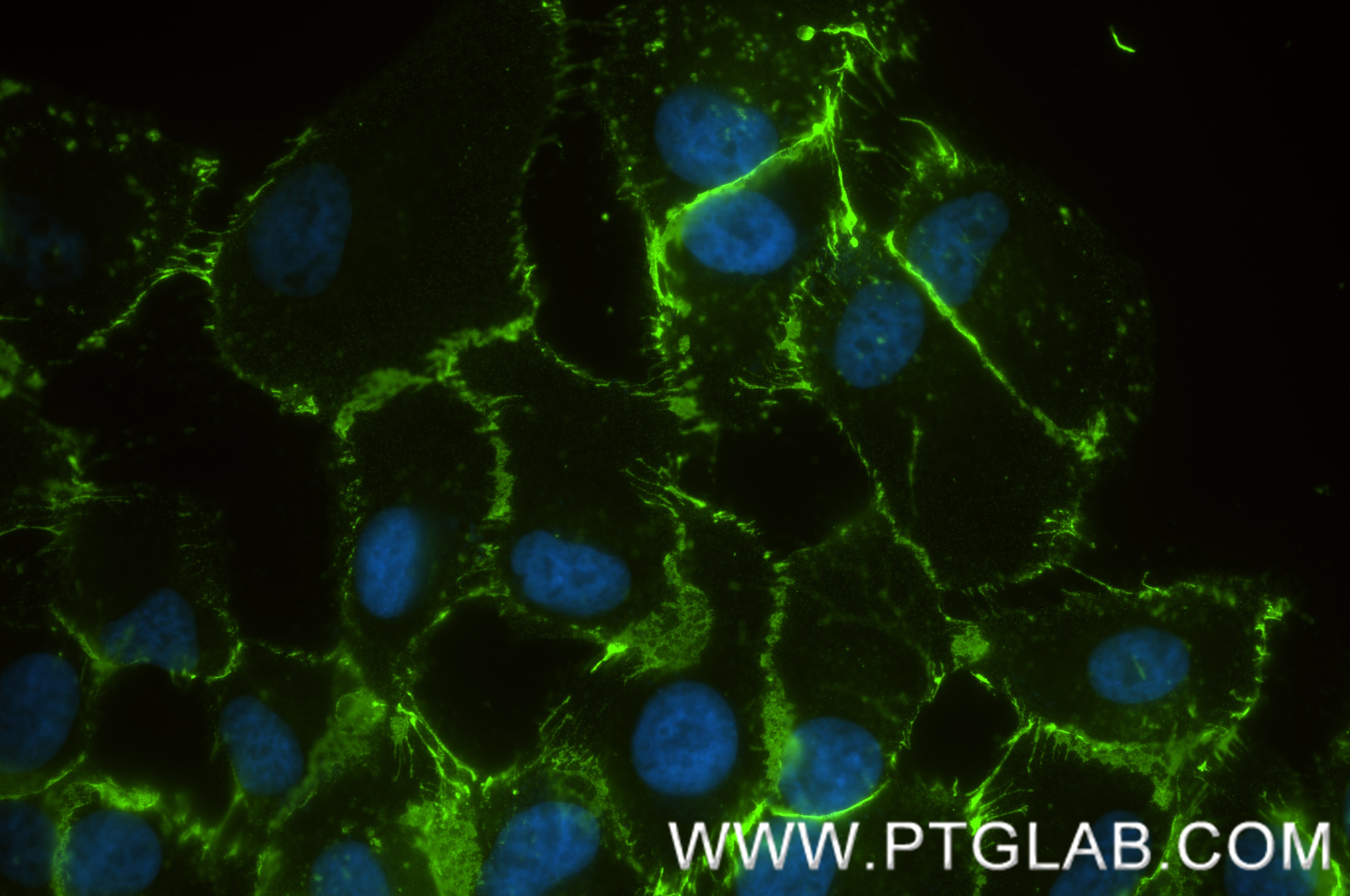 Immunofluorescent analysis of (4% PFA) fixed hTERT-RPE1 cells using ALCAM antibody (65611-1-MR, Clone: 3A6 ) at dilution of 1:400 and CoraLite®488-Conjugated Goat Anti-Mouse IgG(H+L) (SA00013-1). Immunofluorescence (IF) / fluorescent staining of hTERT-RPE1 cells using Anti-Human ALCAM (3A6) Mouse IgG2a Recombinant Ant (65611-1-MR)
