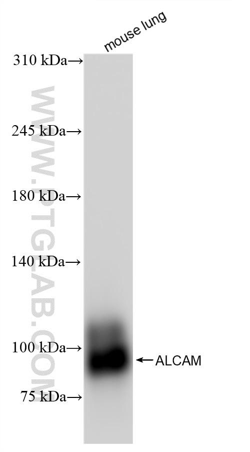 Western Blot (WB) analysis of mouse lung tissue using ALCAM Recombinant antibody (84528-1-RR)
